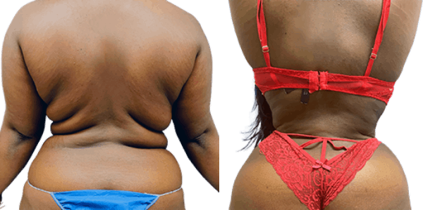bna thumbnail three