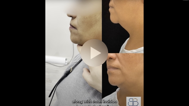 Patient success video thumbnail