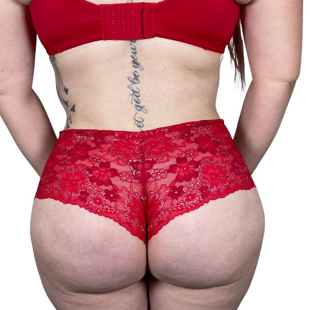 Brazilian Butt Lift Before & After Patient #145