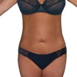 tummy-tuck-713-view-1-detail-копия-4-копия-420x666