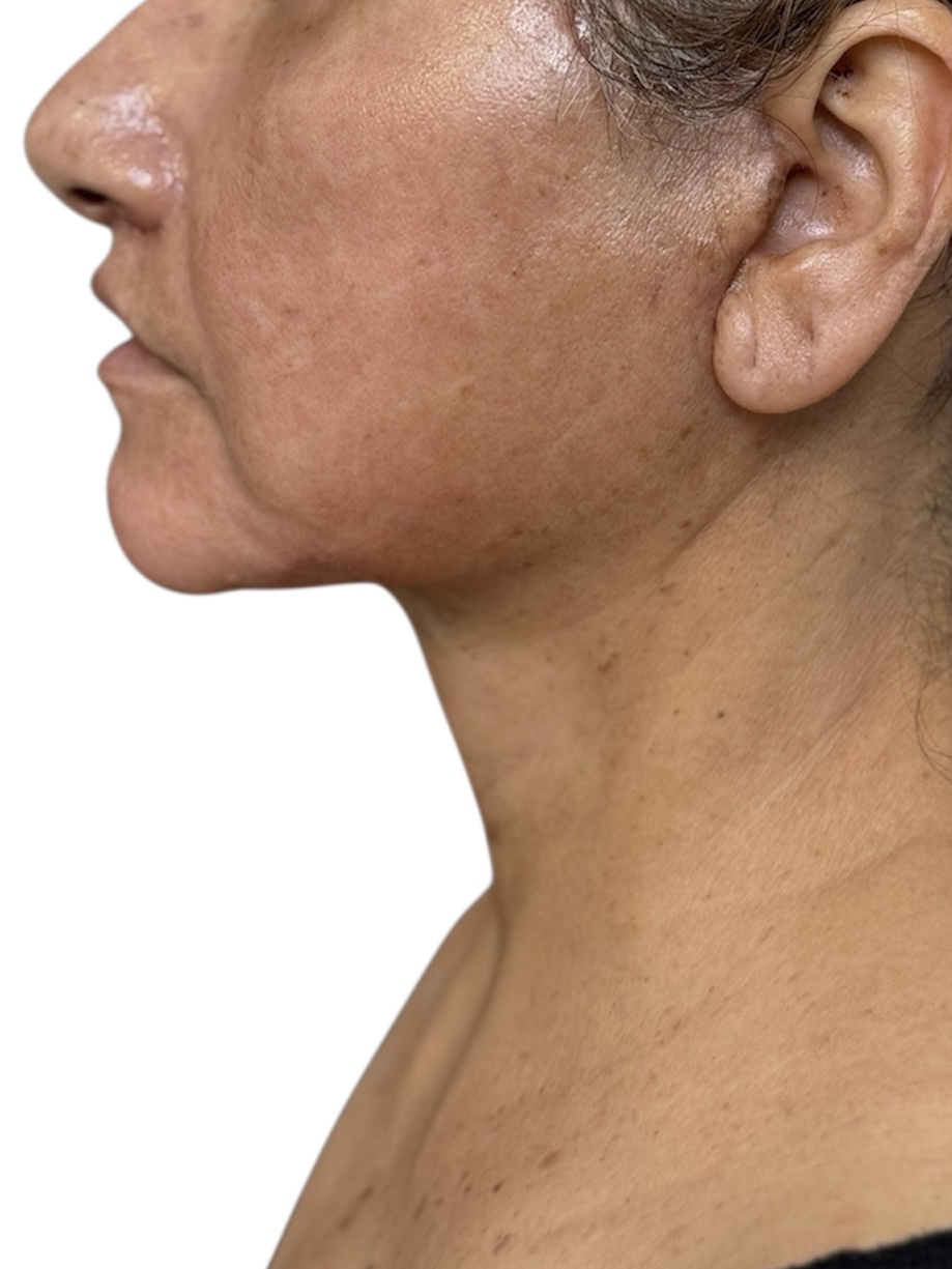 neck after
