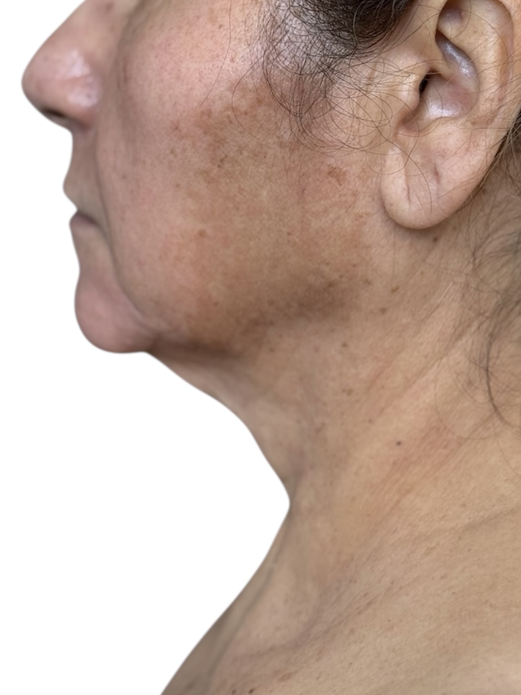 neck before