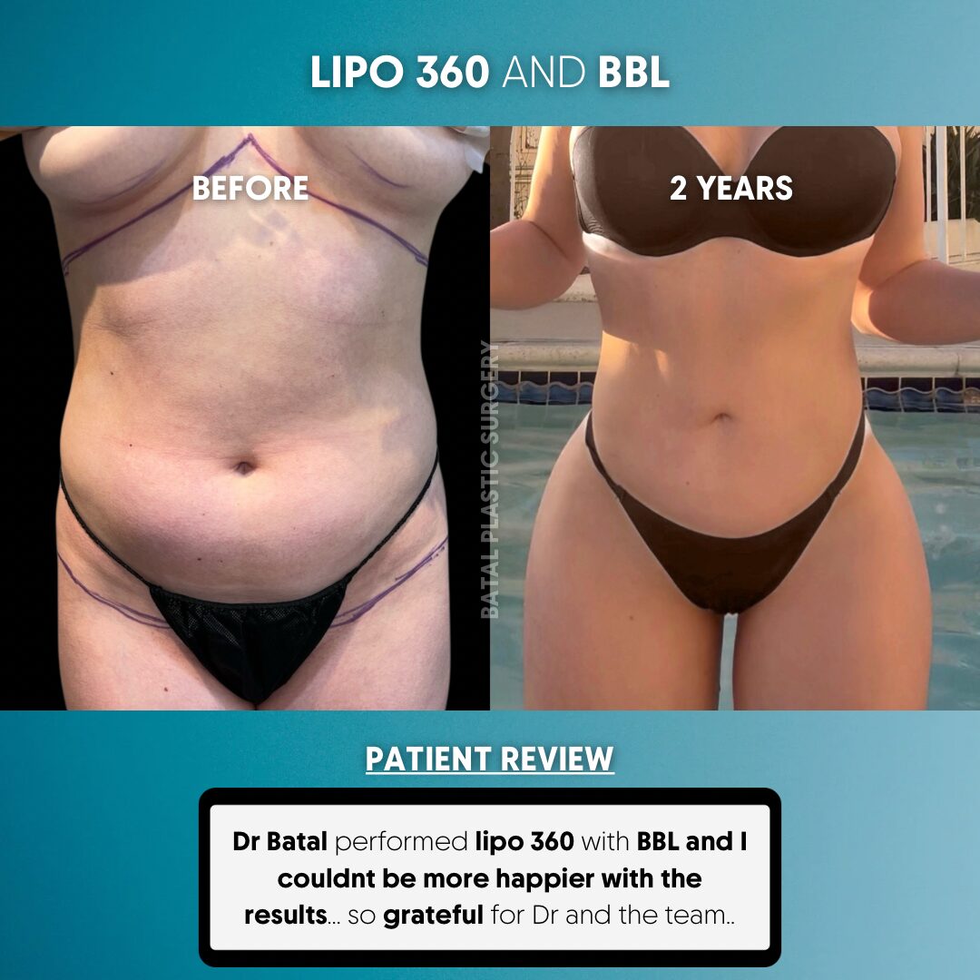 $899 per area - !. → (2)(1)