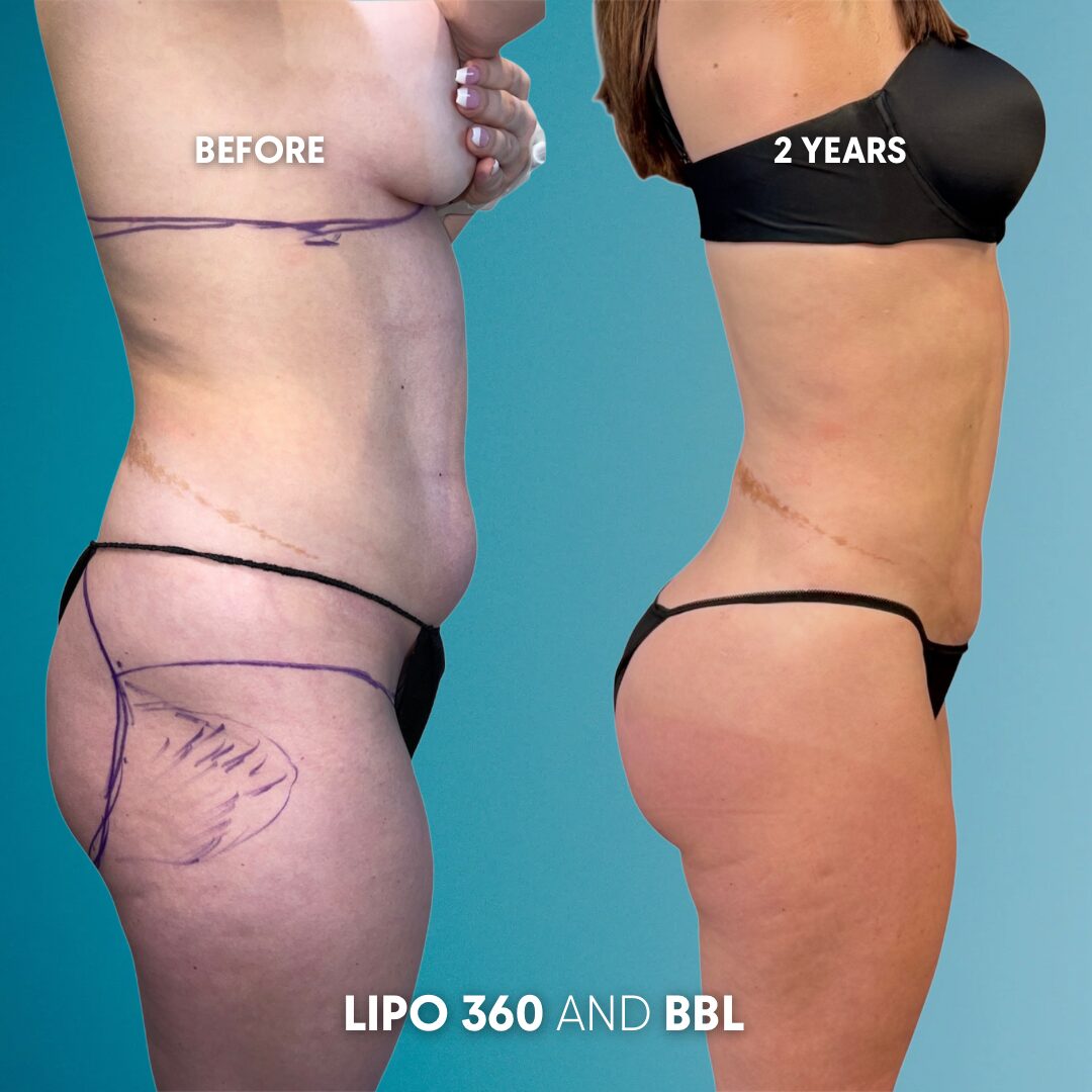 $899 per area - !. → (3)(1)