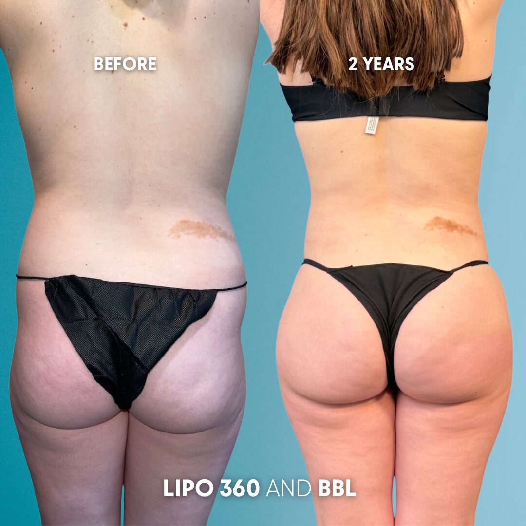 $899 per area - !. →(1)