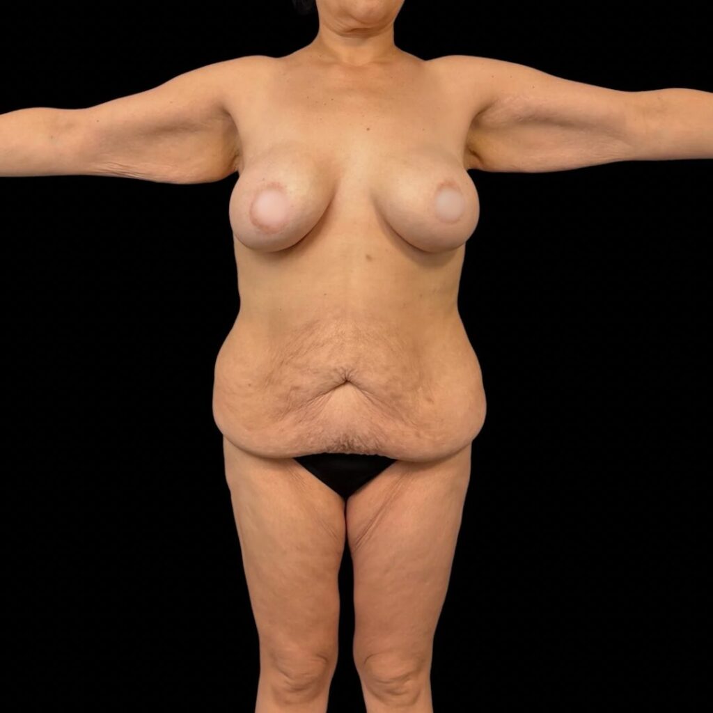 $899 per area - !. → 6