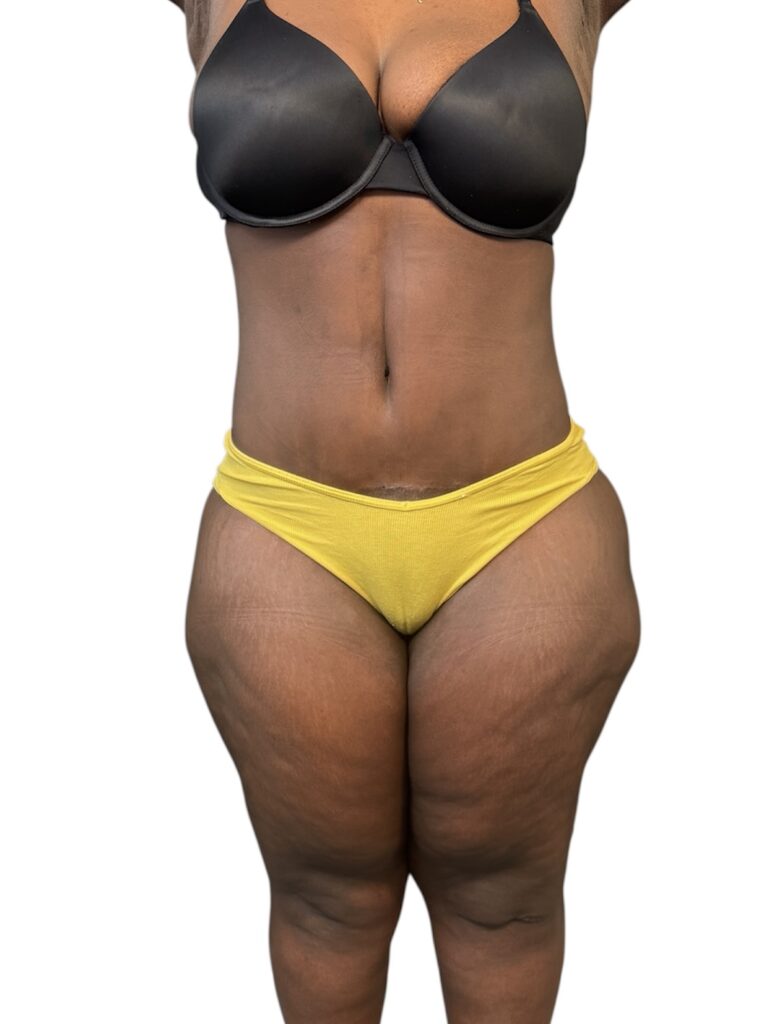 Photoroom_20250812_104731