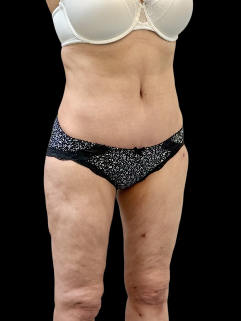 Photoroom_20251110_150152