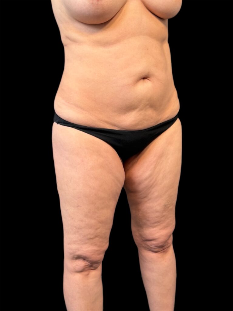 Photoroom_20251110_150251