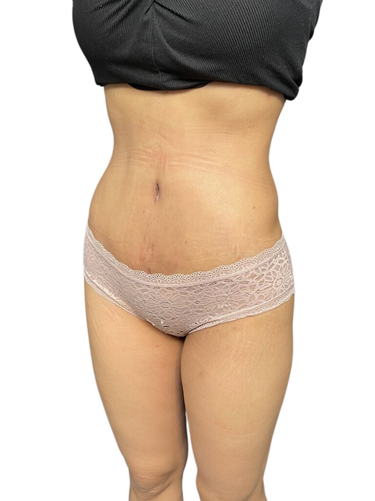 Photoroom_20251110_152824 2