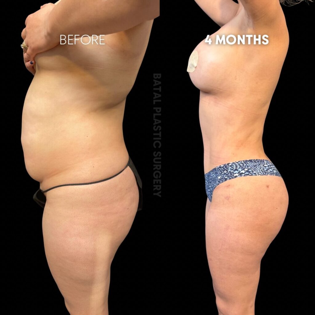 $899 per area - !. →