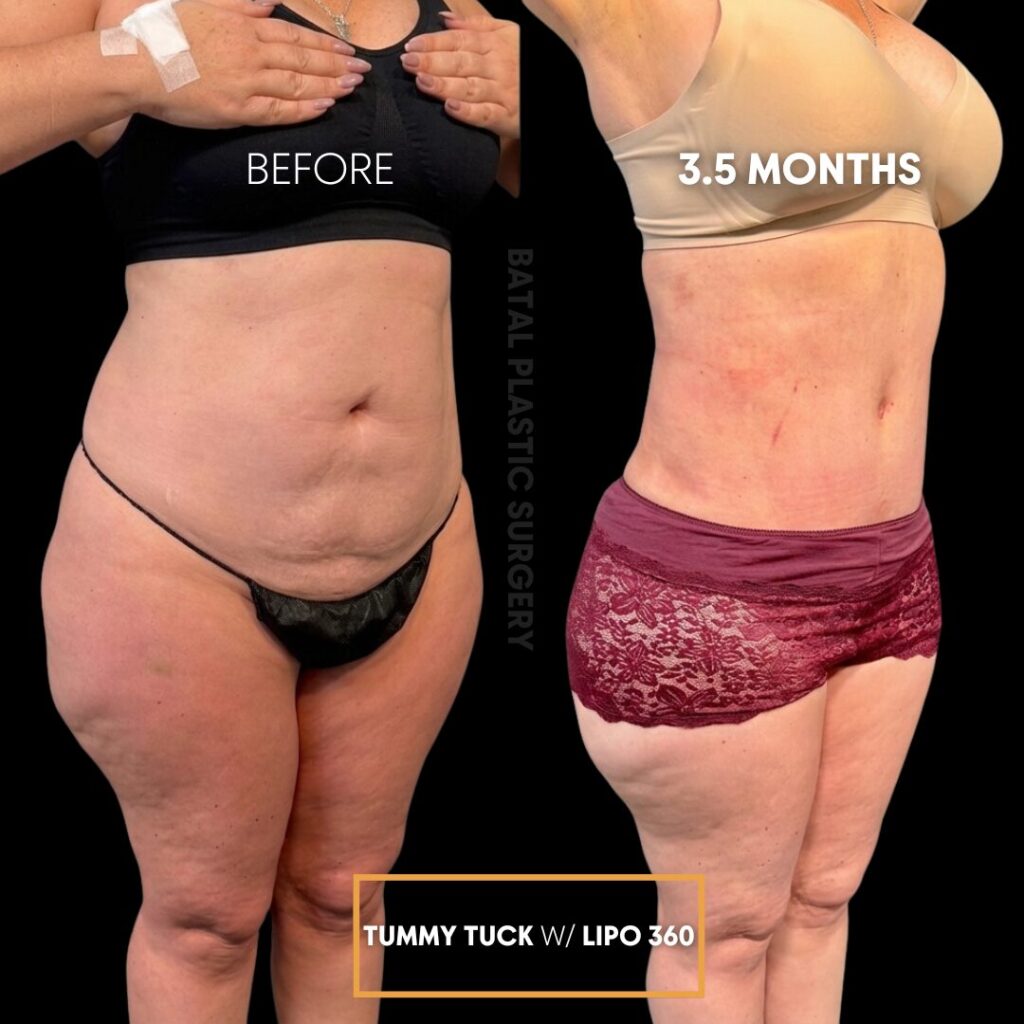 $899 per area - !. → (2)