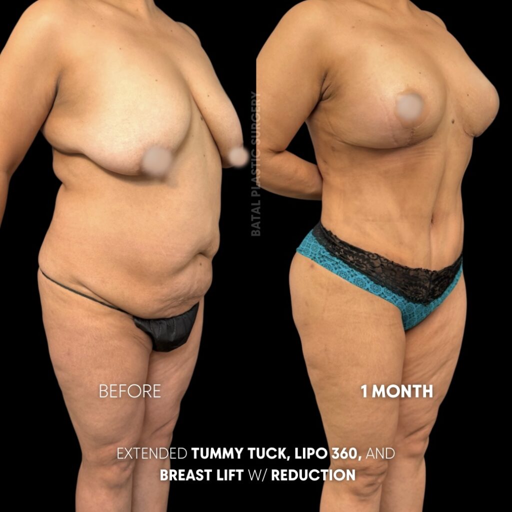 $899 per area - !. → (2)