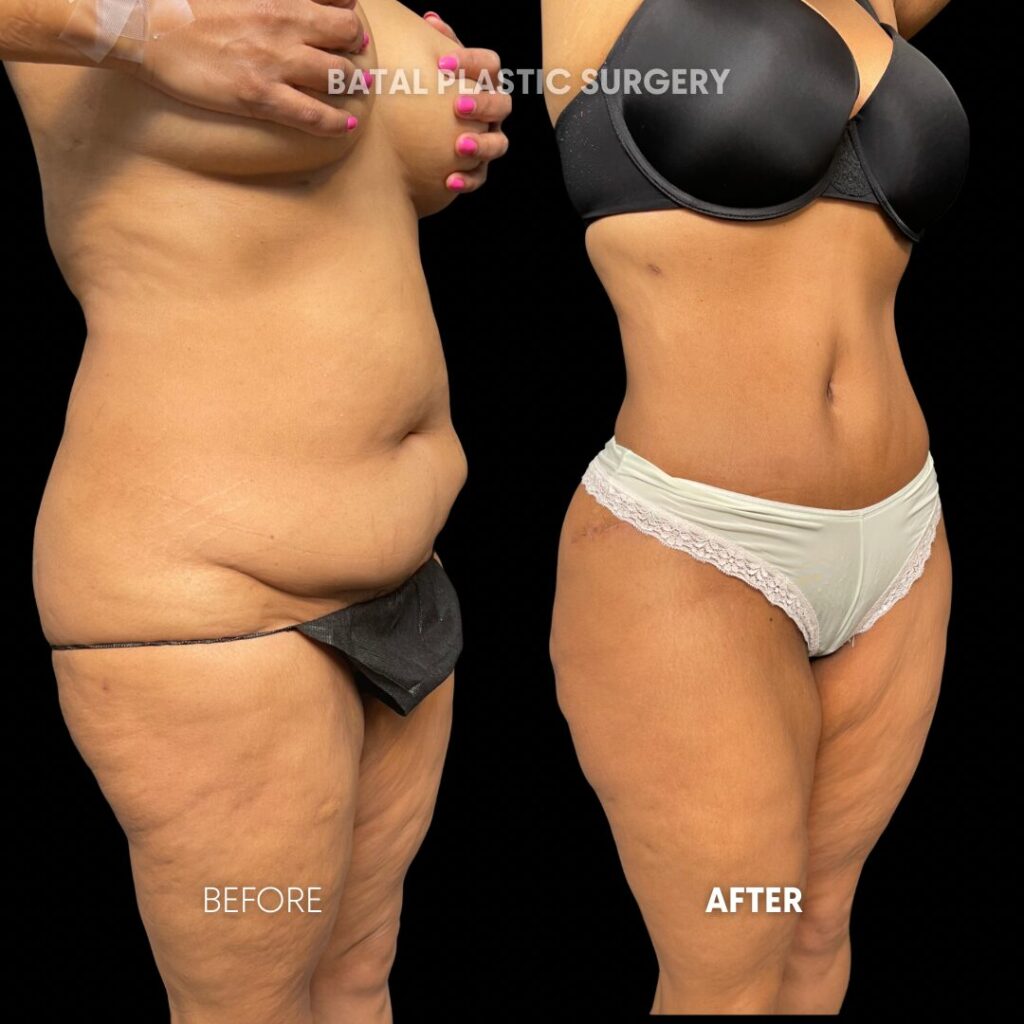 $899 per area - !. → (2)(1)