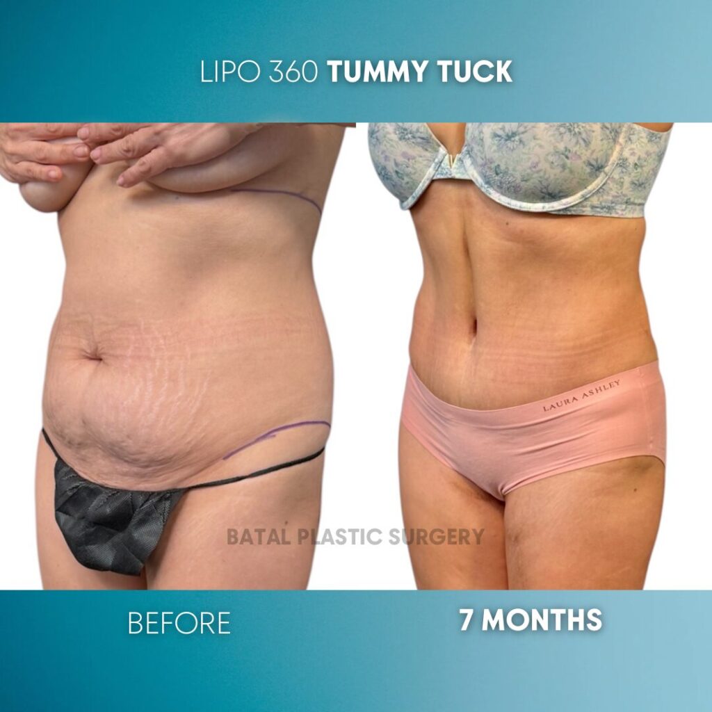 $899 per area - !. → (2)(4)