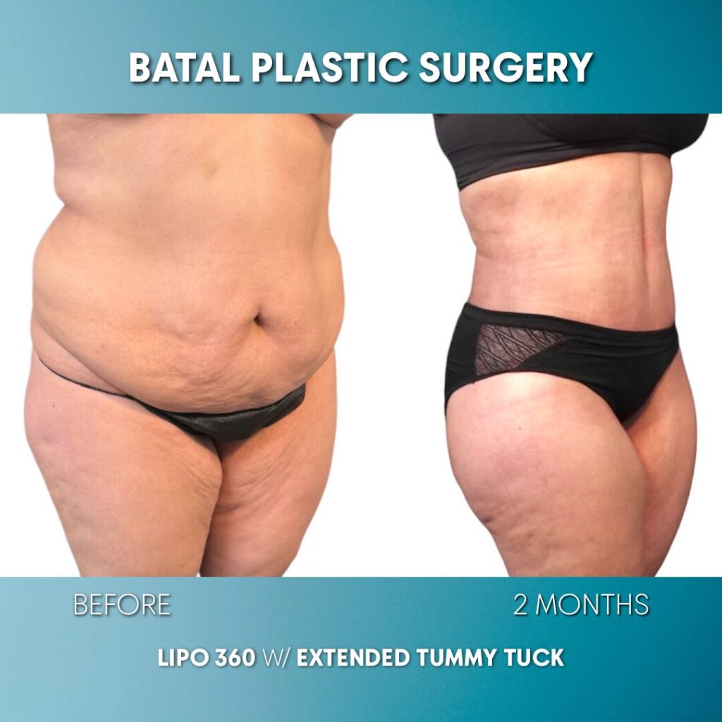 $899 per area - !. → (2)(6)