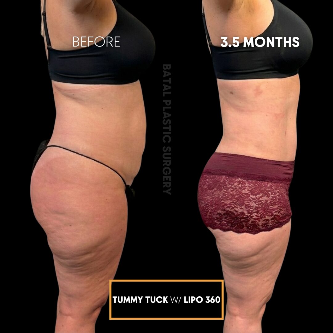 $899 per area - !. → (3)