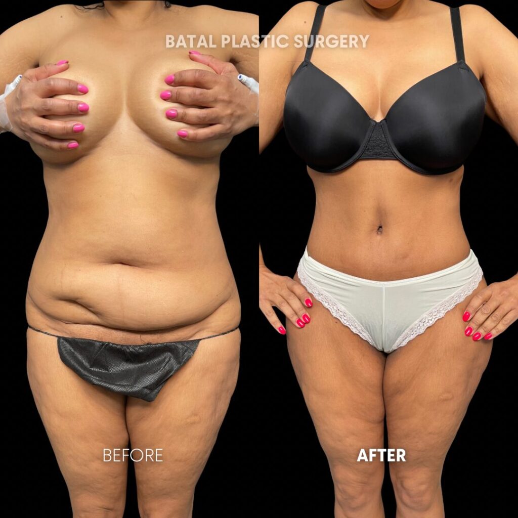 $899 per area - !. → (3)(1)