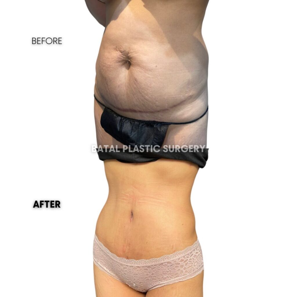 $899 per area - !. → (3)(2)