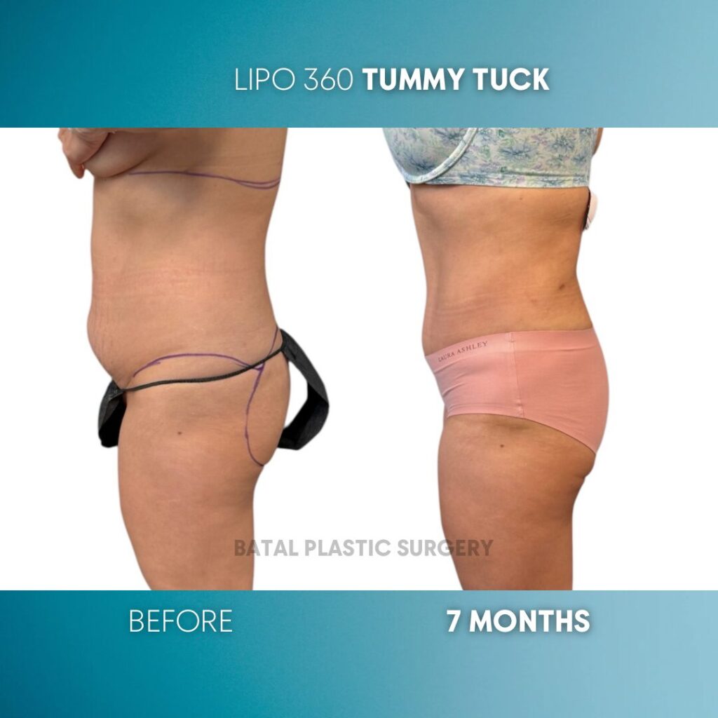 $899 per area - !. → (3)(5)