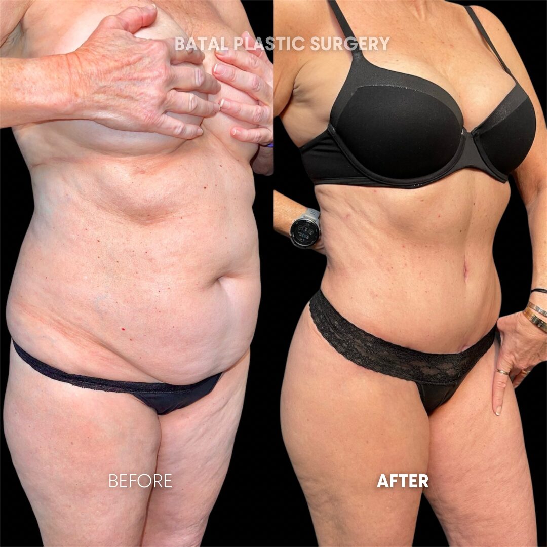 $899 per area - !. → (4)