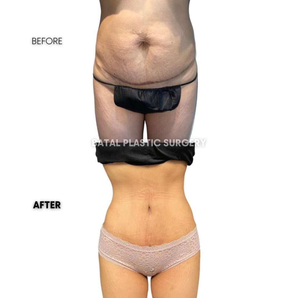 $899 per area - !. → (4)(1)