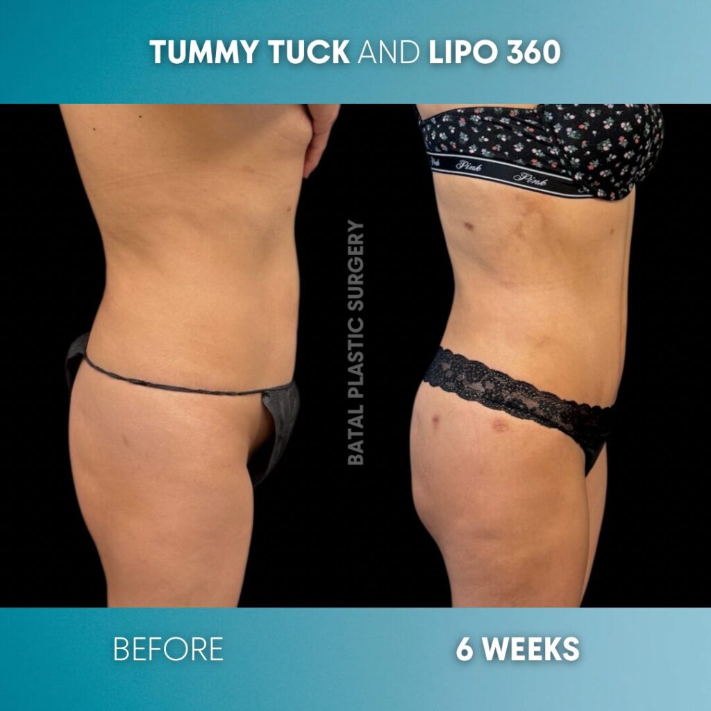 $899 per area - !. → (4)(2)