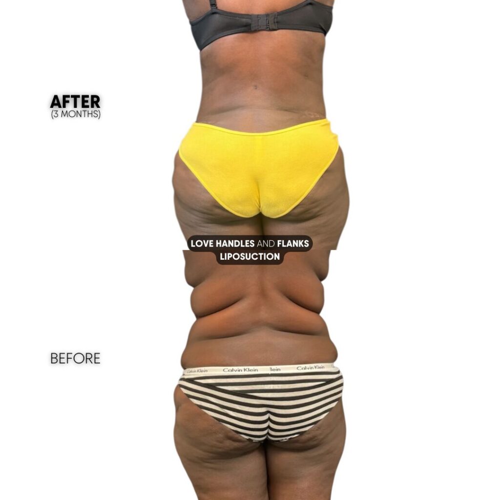 $899 per area - !. → (4)(3)