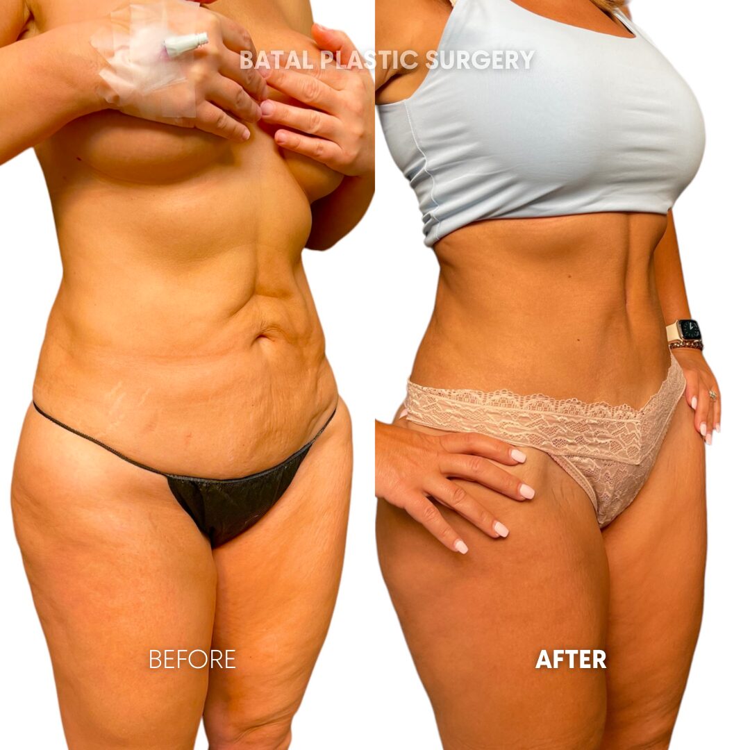 $899 per area - !. → (5)