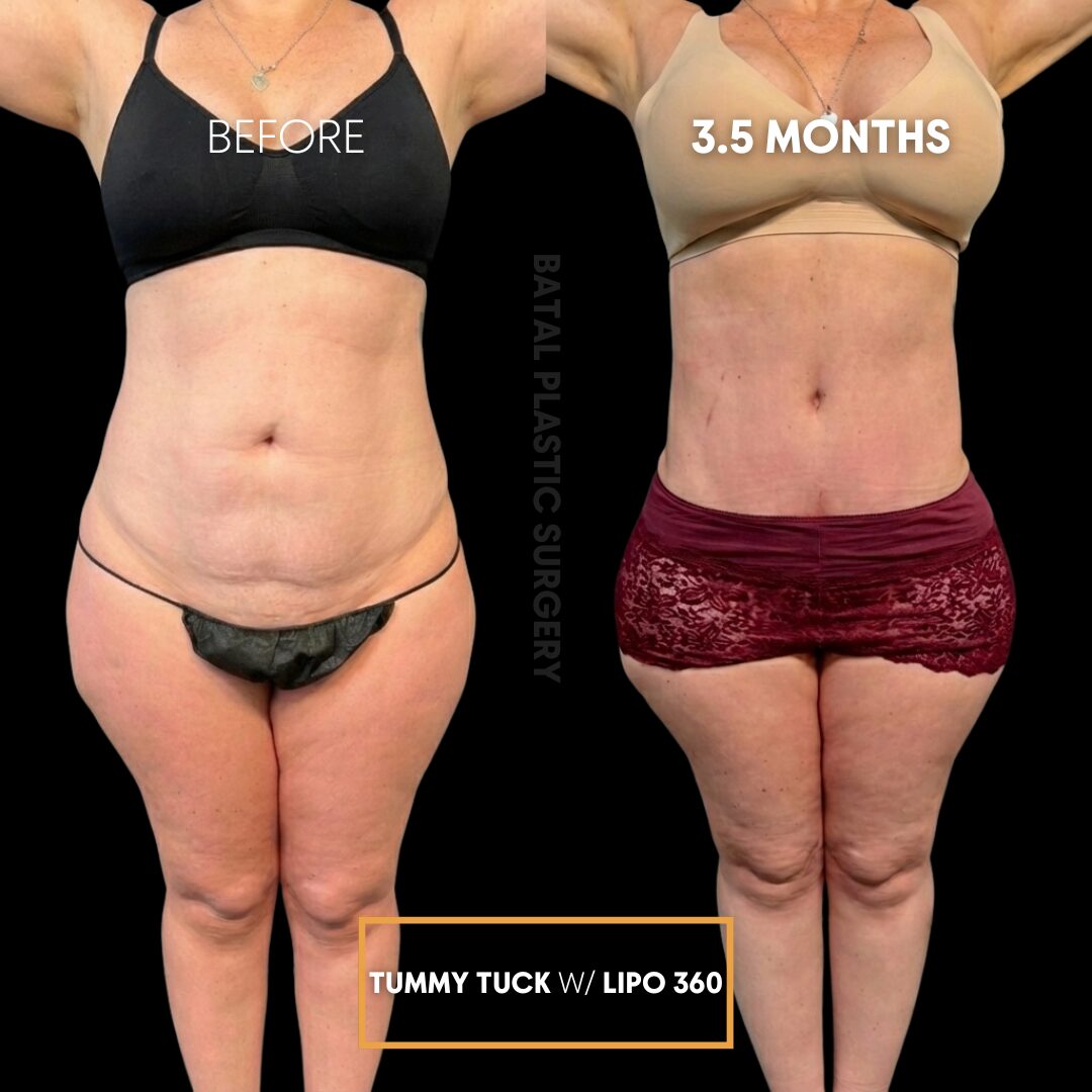 $899 per area - !. →(1)