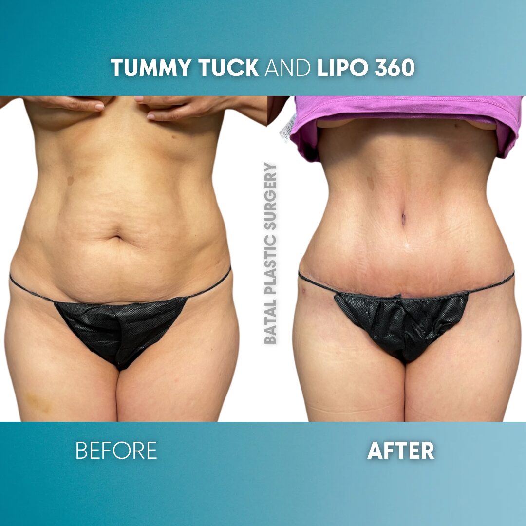 $899 per area - !. →(2)