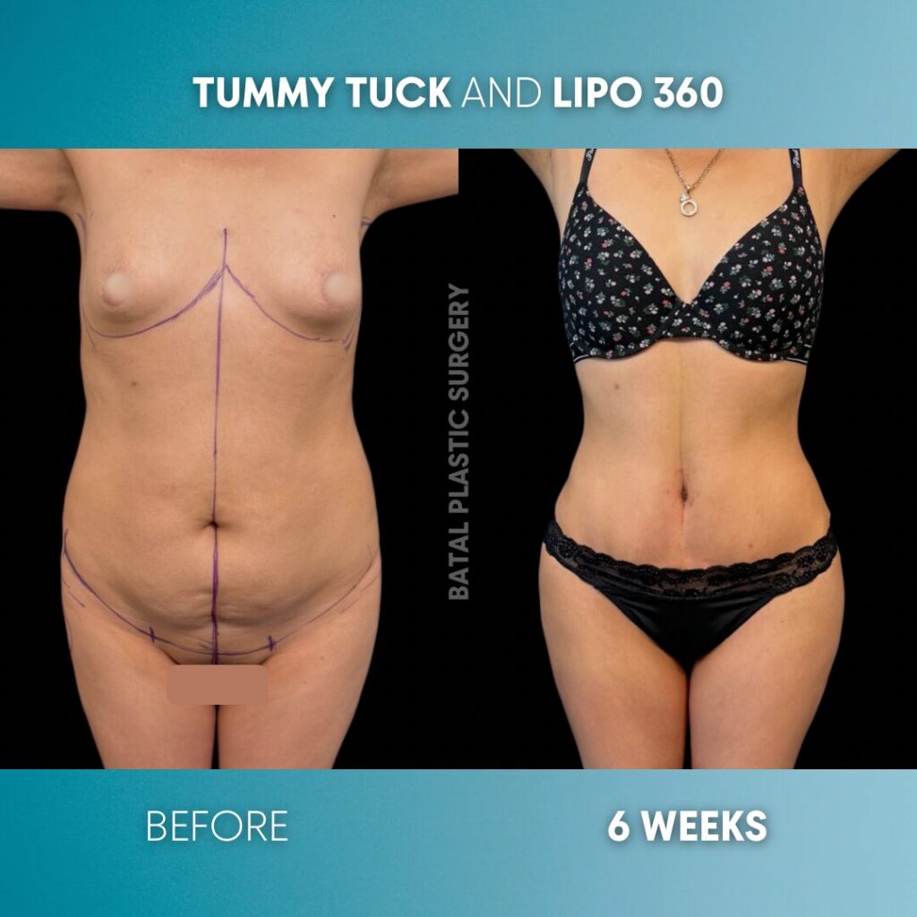 $899 per area - !. →(3)