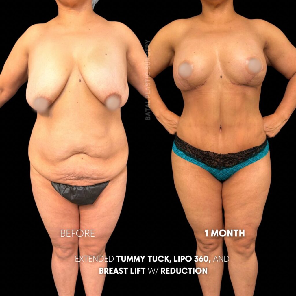 $899 per area - !. →(4)