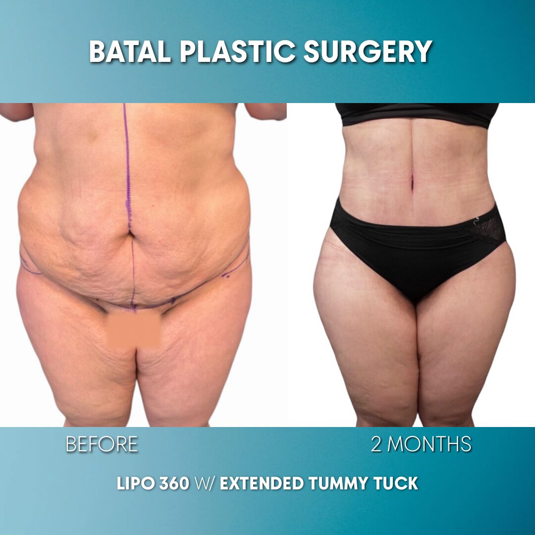 $899 per area - !. →(5)