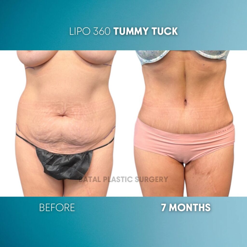 $899 per area - !. →(6)