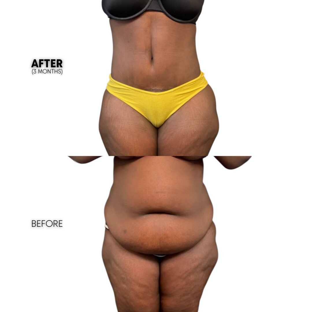 $899 per area - !. →(7)