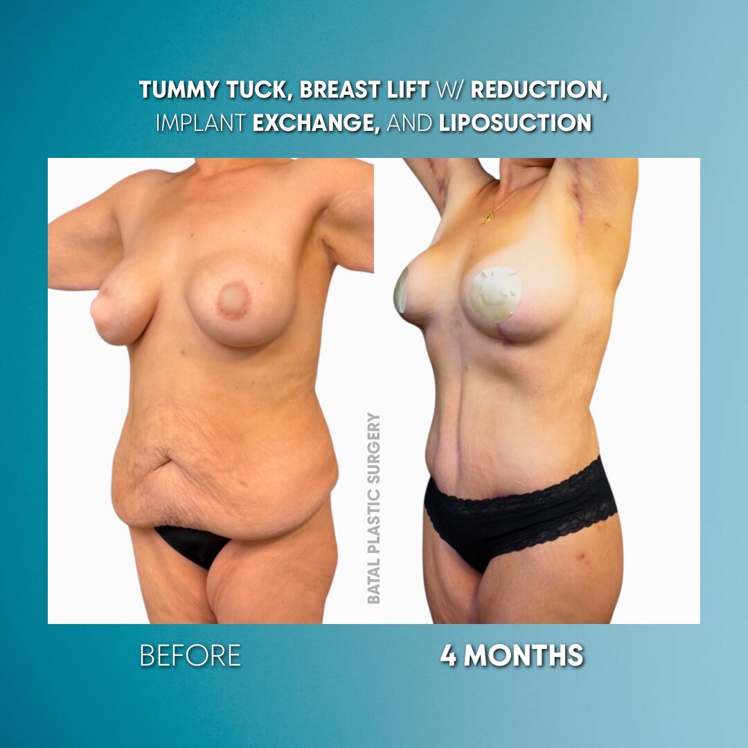 $899 per area - ! Ì. → (2)