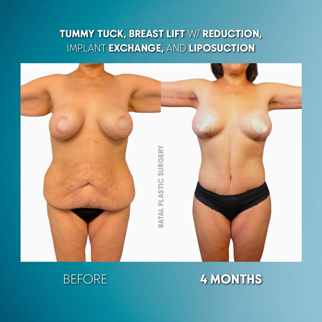 $899 per area - ! Ì. →