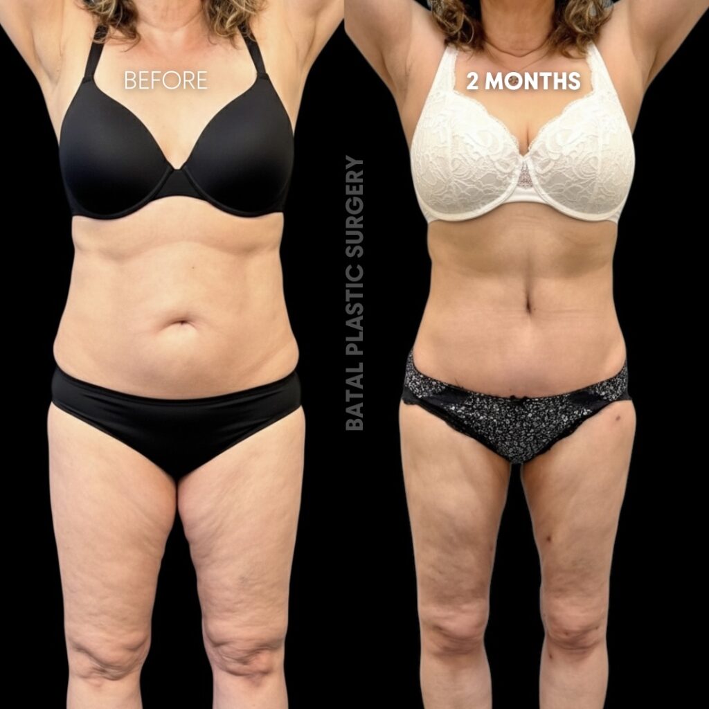 $899 per area - !. →