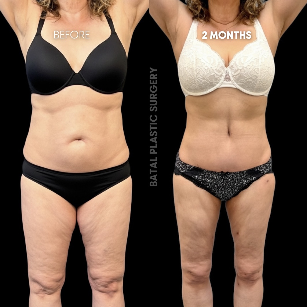 $899 per area - !. →