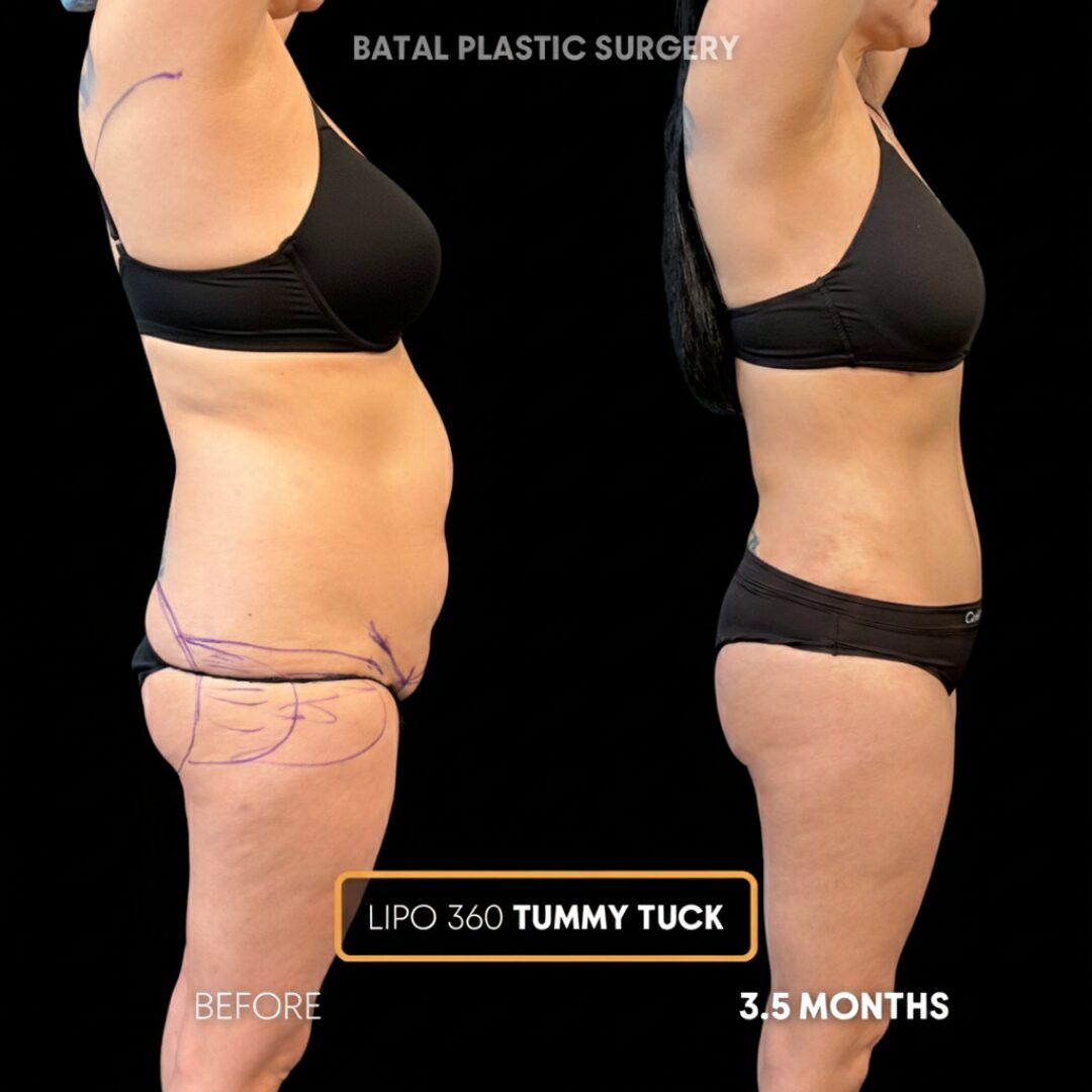 Copy of $899 per area - !. → (4)