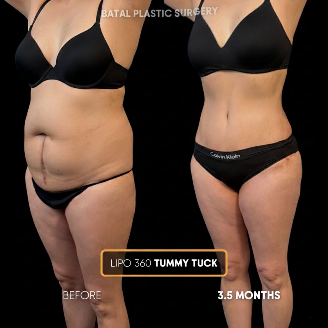 Copy of $899 per area - !. →