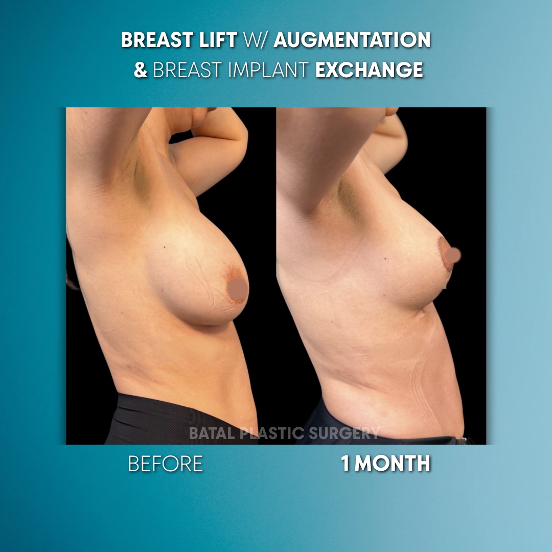 294819A4-9B8A-409C-9A40-82346C73DD47