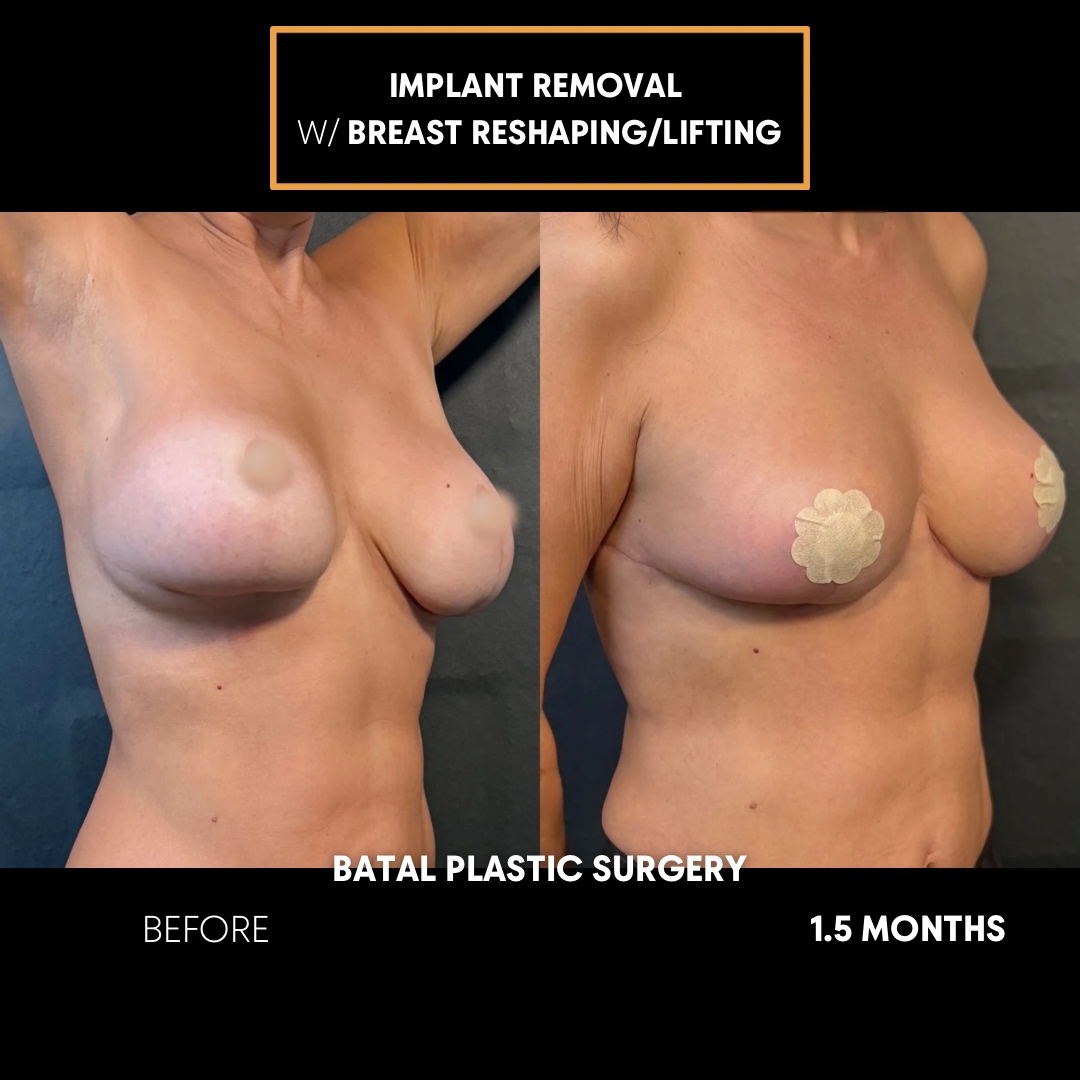 4312CFF6-DDDC-4187-94C7-5BC87B348DD2