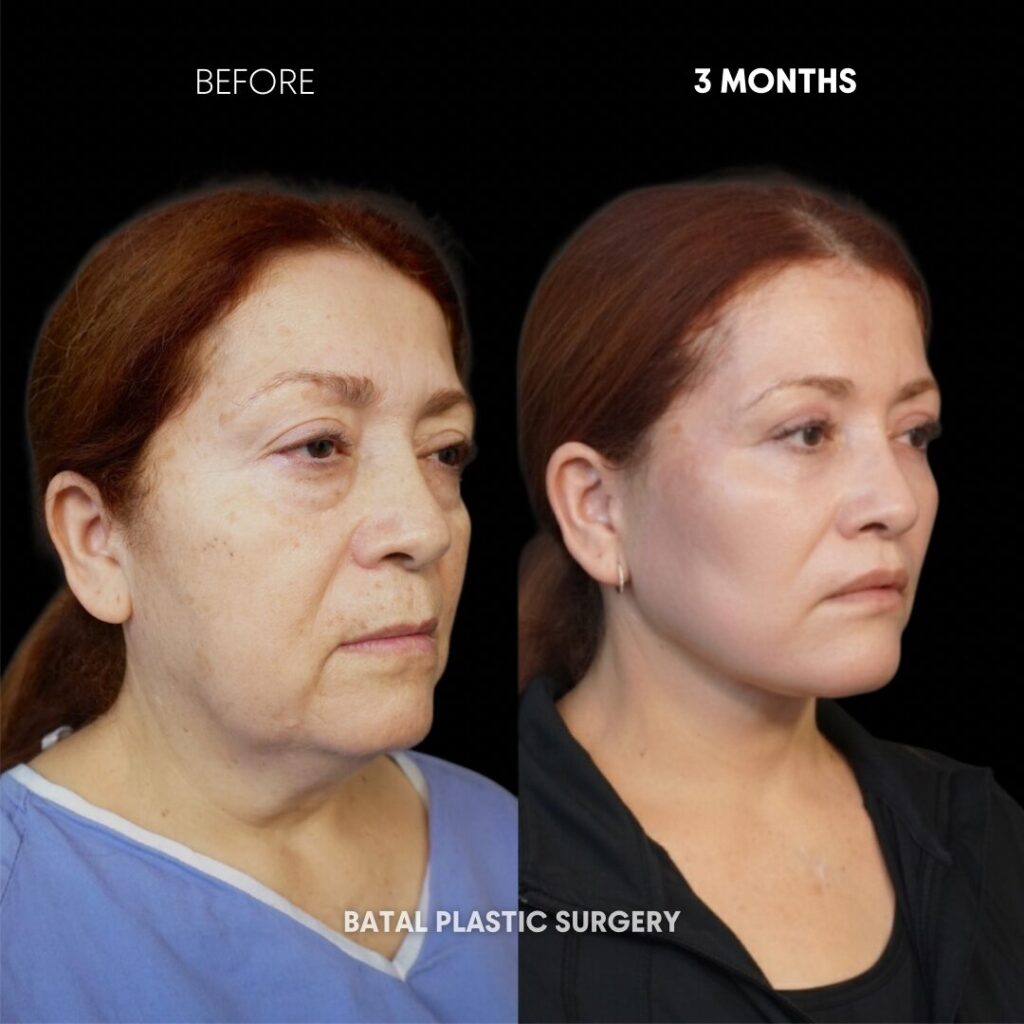 $899 per area - !. → 11