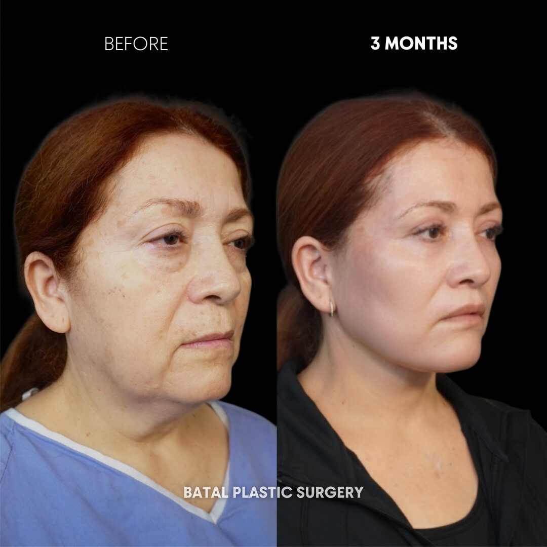 $899 per area - !. → 11