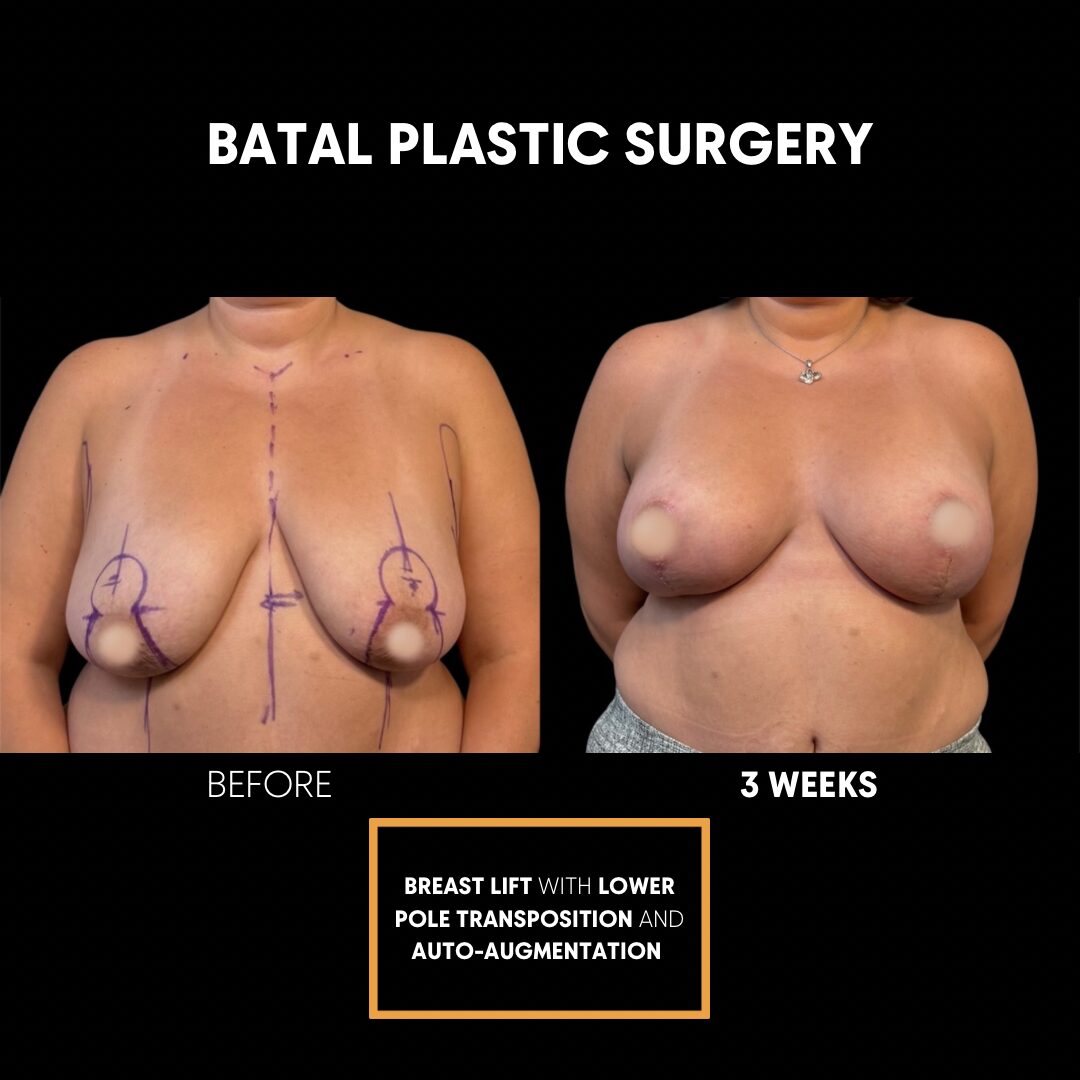 $899 per area - !. → 18