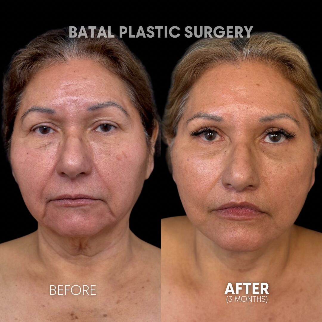 $899 per area - !. → (2) 12