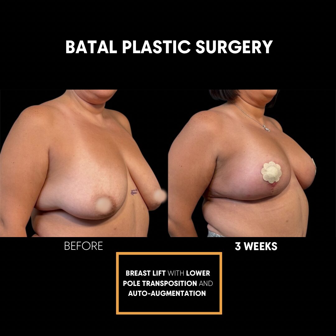 $899 per area - !. → (2) 22