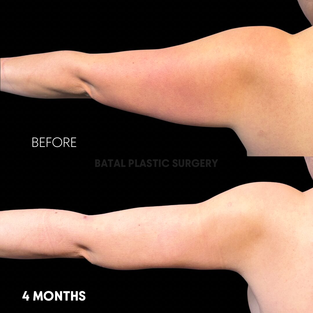 $899 per area - !. → (2) 27